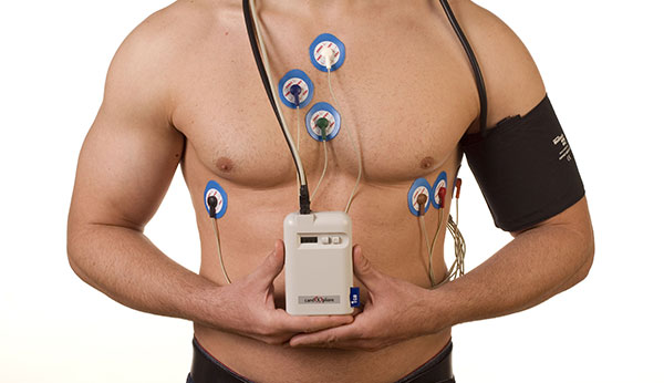 ECG (Holter) Monitoring test