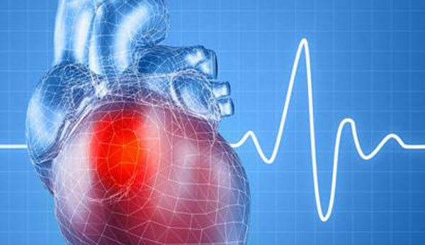 Arrhythmia image