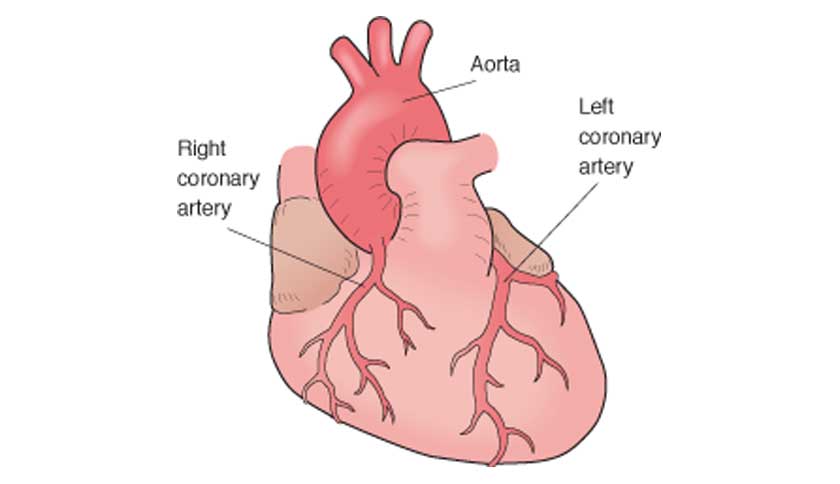 Angiogram