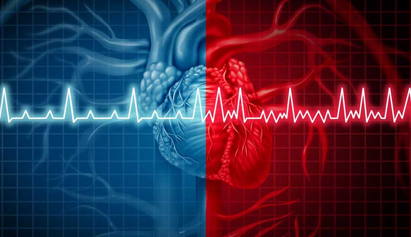 Atrial Fibrillation As Condition