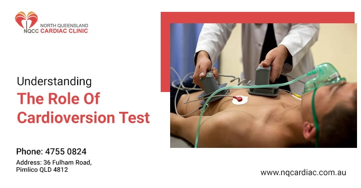 Understanding The Role Of Cardioversion Test