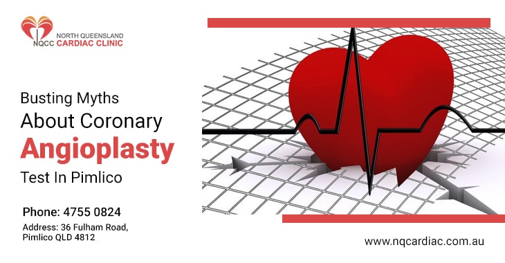 Busting Myths About Coronary Angioplasty Test In Pimlico