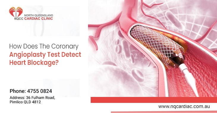 How Does The Coronary Angioplasty Test Detect Heart Blockage?