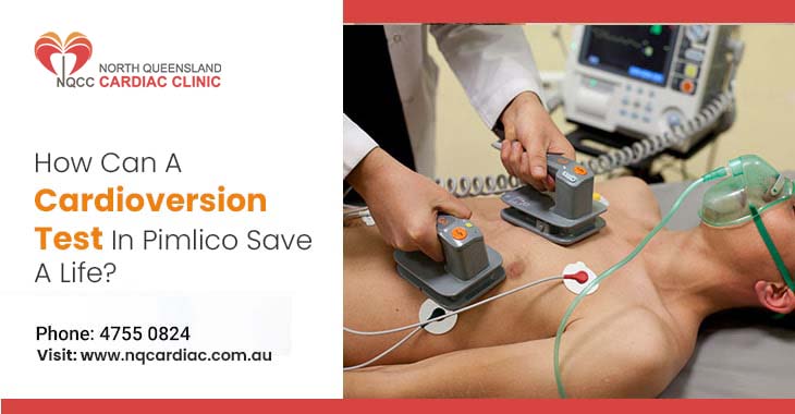 How Can A Cardioversion Test In Pimlico Save A Life?