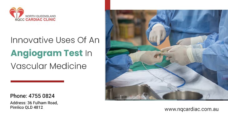 Innovative Uses Of An Angiogram Test In Vascular Medicine