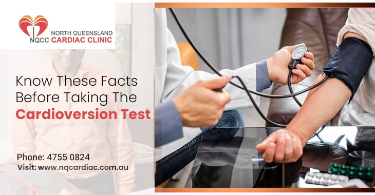 Know These Facts Before Taking The Cardioversion Test
