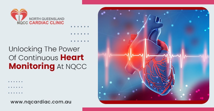 Unlocking The Power Of Continuous Heart Monitoring At NQCC