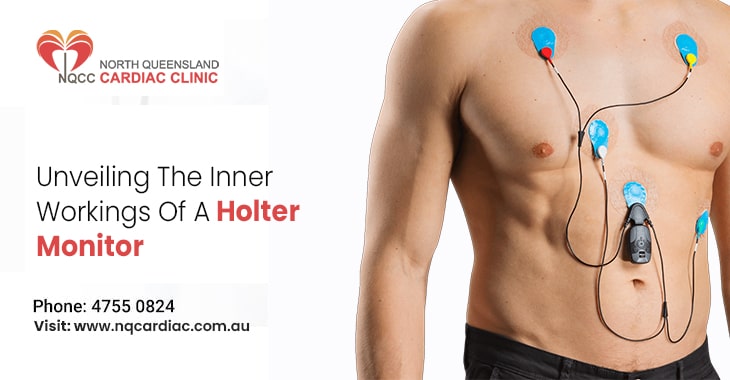Unveiling The Inner Workings Of A Holter Monitor
