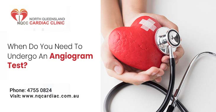 When Do You Need To Undergo An Angiogram Test?